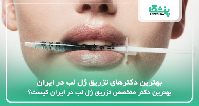 بهترین دکترهای تزریق ژل لب در ایران