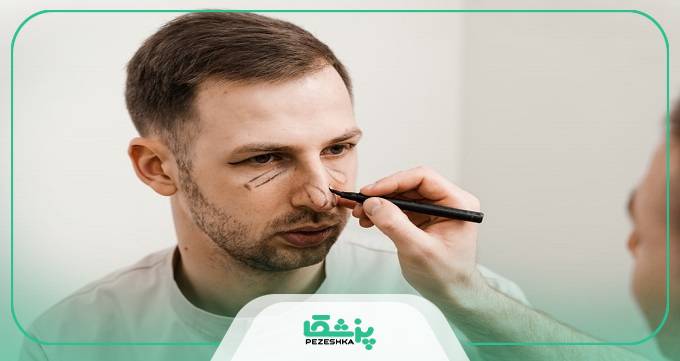 هزینه جراحی بینی مردانه در ایران چقدر است؟