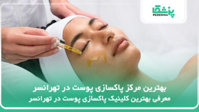 بهترین مرکز پاکسازی پوست در تهرانسر