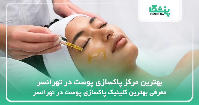 بهترین مرکز پاکسازی پوست در تهرانسر