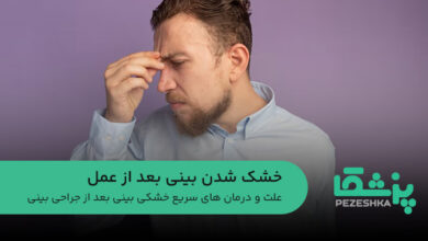 خشک شدن بینی بعد از عمل