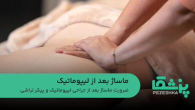 ماساژ بعد از لیپوماتیک
