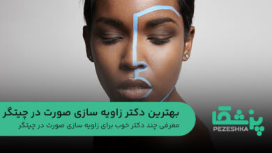 معرفی چند دکتر خوب برای زاویه سازی صورت در چیتگر
