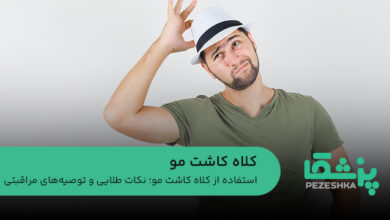 کلاه کاشت مو