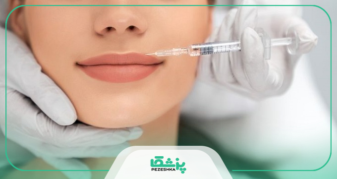 نحوه خوابیدن بعد از تزریق ژل لب