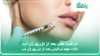 مراقبت های بعد از تزریق ژل لب