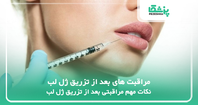 مراقبت های بعد از تزریق ژل لب