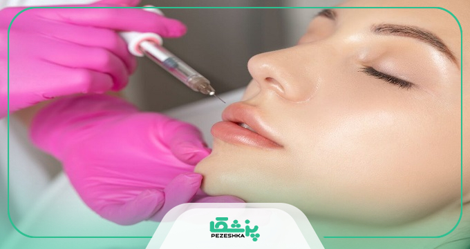 قیمت حدودی تزریق ژل لب روسی در مشهد