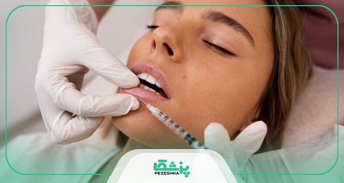راهنمای رزرو نوبت و مشاوره با بهترین دکتر تزریق ژل لب در مشهد