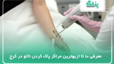 بهترین مرکز پاک کردن تاتو در کرج