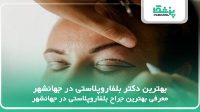 بهترین دکتر بلفاروپلاستی در جهانشهر