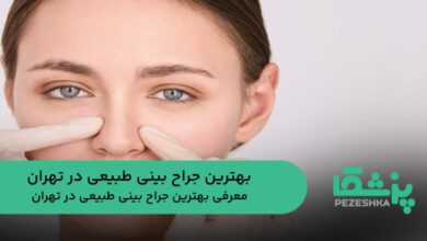 بهترین جراح بینی طبیعی در تهران