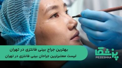 بهترین جراح بینی فانتزی در تهران