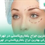 10 تا از بهترین جراح بلفاروپلاستی در تهران【سال1404】✅