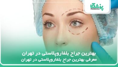 بهترین جراح بلفاروپلاستی در تهران