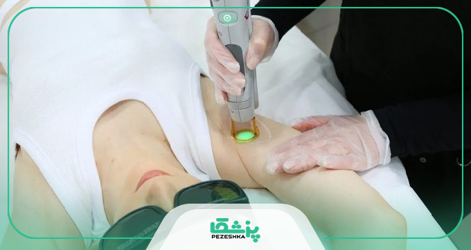 توصیه‌های مراقبتی متخصصان بهترین مرکز لیزر فرکشنال co2 در تهران