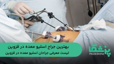بهترین جراح اسلیو معده در قزوین
