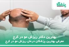 بهترین دکتر ریزش مو در کرج