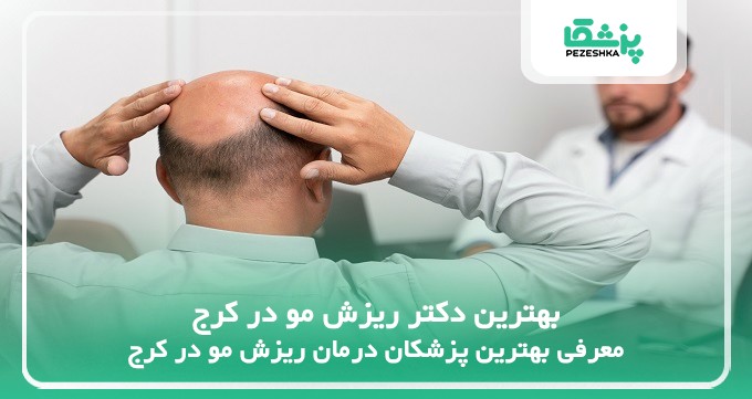 بهترین دکتر ریزش مو در کرج