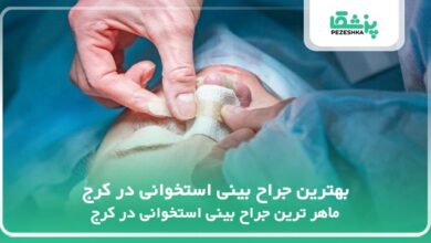 بهترین جراح بینی استخوانی در کرج