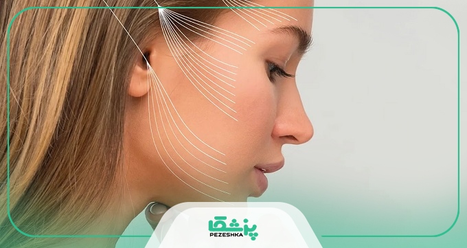 بهترین برند نخ لیفت برای جوانسازی پوست