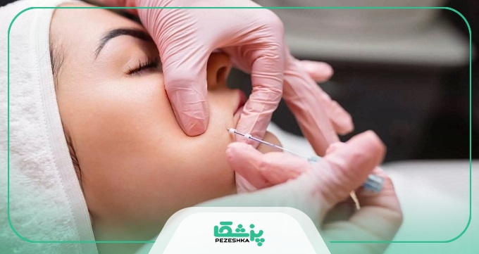 مزایای مراجعه به بهترین دکتر لیفت با نخ در تهران