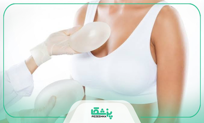 چگونه یک جراح خوب برای پروتز سینه انتخاب کنیم؟