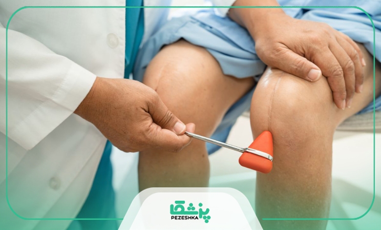 توصیههای مراقبتی بهترین دکتر تعویض مفصل زانو در تهران