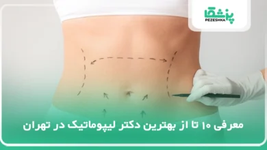 10 تا از بهترین دکتر لیپوماتیک در تهران