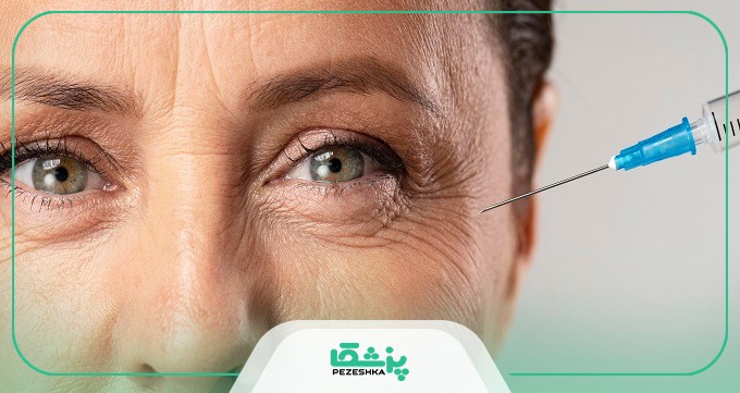 کاندیدای مراجعه به بهترین دکتر بوتاکس تهران