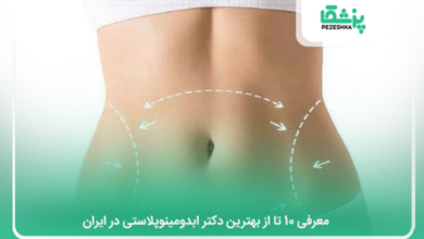 بهترین دکتر ابدومینوپلاستی در ایران