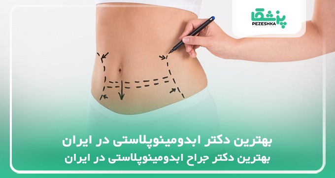 بهترین دکتر ابدومینوپلاستی در ایران