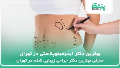 بهترین دکتر ابدومینوپلاستی در تهران