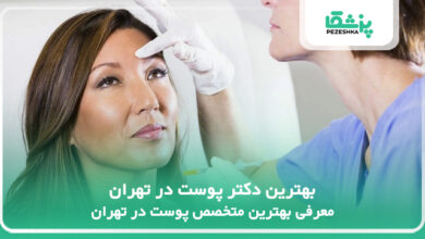 بهترین دکتر پوست در تهران