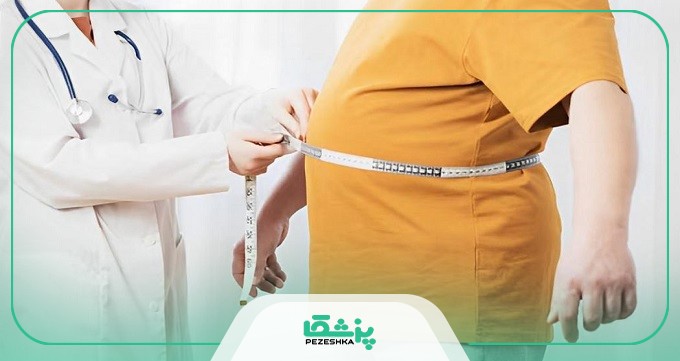 هزینه جراحی اسلیو معده در کرج چقدر است؟