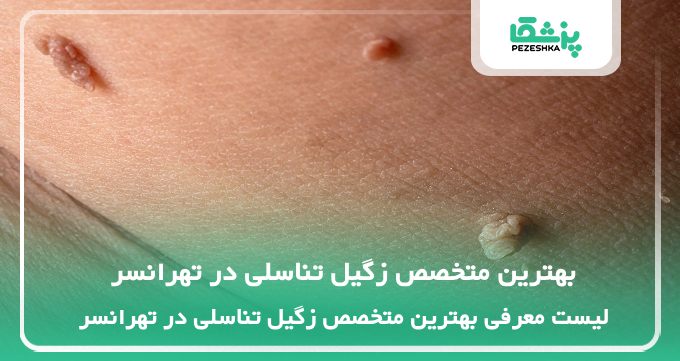 بهترین متخصص زگیل تناسلی در تهرانسر