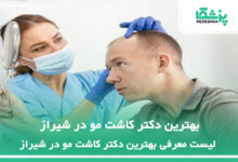 بهترین دکتر کاشت مو در شیراز