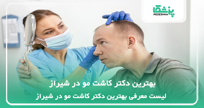 بهترین دکتر کاشت مو در شیراز
