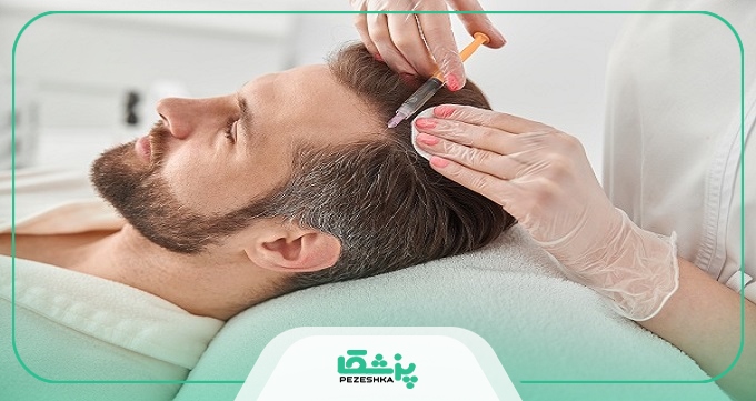 هزینه مزوتراپی توسط بهترین متخصص مزوتراپی در تهران