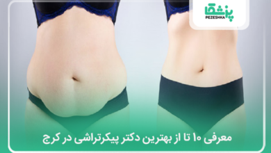 بهترین دکتر پیکرتراشی در کرج