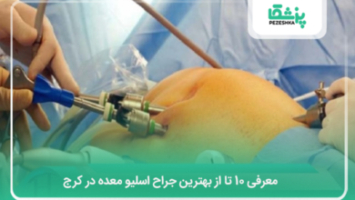 بهترین جراح اسلیو در کرج