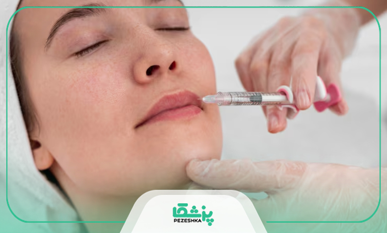 چگونه بهترین دکتر تزریق ژل در اصفهان را انتخاب کنیم؟
