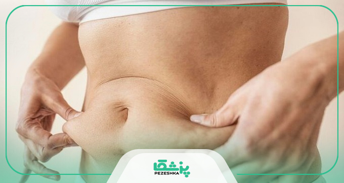 هزینه خدمات بهتربن جراح ابدومینوپلاستی اندرزگو چقدر است؟
