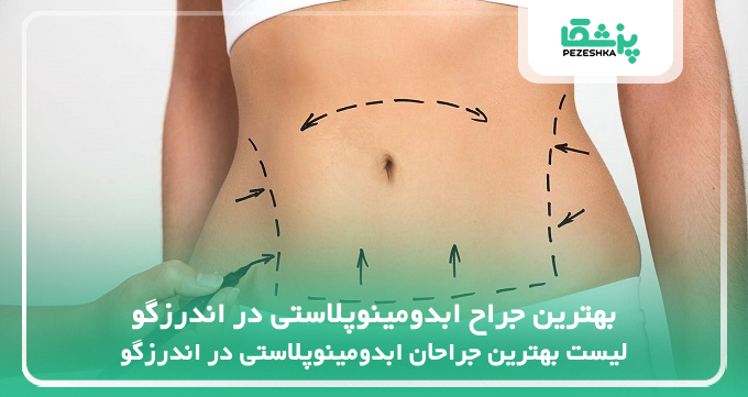 بهترین جراح ابدومینوپلاستی در اندرزگو