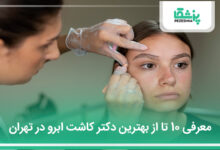 بهترین دکتر کاشت ابرو در تهران