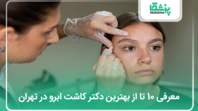 بهترین دکتر کاشت ابرو در تهران