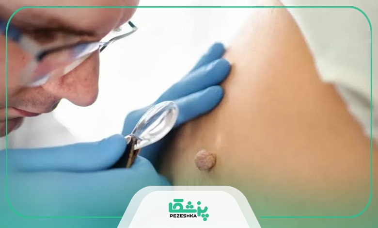 چگونه بهترین دکتر زگیل تناسلی در شریعتی را انتخاب کنیم؟
