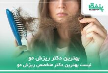 بهترین دکتر ریزش مو