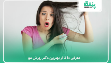 بهترین دکتر ریزش مو