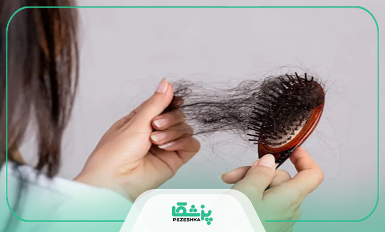 خدمات بهترین دکتر متخصص ریزش مو